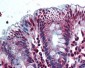 AKR1B10 Antibody (aa100-200)